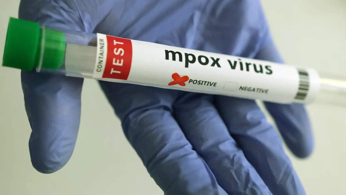 WHO Approves Emergency Mpox Test to Boost Global Detection